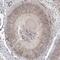 CDK5 Regulatory Subunit Associated Protein 3 antibody, PA5-54627, Invitrogen Antibodies, Immunohistochemistry paraffin image 