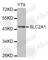 Solute Carrier Family 2 Member 1 antibody, A3330, ABclonal Technology, Western Blot image 