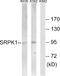 SRSF Protein Kinase 1 antibody, A01937, Boster Biological Technology, Western Blot image 