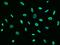 Protein Phosphatase 1 Catalytic Subunit Gamma antibody, GTX02380, GeneTex, Immunofluorescence image 