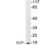 Ribonuclease A Family Member 3 antibody, LS-B12777, Lifespan Biosciences, Western Blot image 