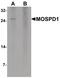 Motile Sperm Domain Containing 1 antibody, PA5-34529, Invitrogen Antibodies, Western Blot image 