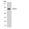 T-Box 3 antibody, LS-C200767, Lifespan Biosciences, Western Blot image 