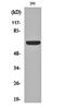 Potassium Voltage-Gated Channel Subfamily A Member 3 antibody, orb161573, Biorbyt, Western Blot image 