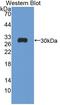 ATPase Na+/K+ Transporting Family Member Beta 4 antibody, LS-C705770, Lifespan Biosciences, Western Blot image 