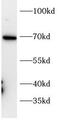 Cell Adhesion Molecule 1 antibody, FNab10751, FineTest, Western Blot image 