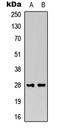 Fibroblast Growth Factor 13 antibody, LS-C368588, Lifespan Biosciences, Western Blot image 