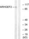 Rho/Rac Guanine Nucleotide Exchange Factor 2 antibody, LS-B9262, Lifespan Biosciences, Western Blot image 