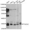 Prostaglandin E Synthase 2 antibody, A13440, ABclonal Technology, Western Blot image 