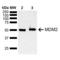 MDM2 Proto-Oncogene antibody, LS-C776173, Lifespan Biosciences, Western Blot image 