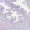 Myozenin 1 antibody, HPA038437, Atlas Antibodies, Immunohistochemistry paraffin image 