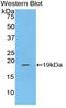 Pleckstrin Homology Like Domain Family A Member 2 antibody, LS-C295973, Lifespan Biosciences, Western Blot image 