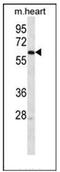 Leucine Rich Repeat And Ig Domain Containing 4 antibody, AP52491PU-N, Origene, Western Blot image 