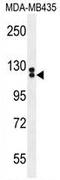 Tubulin polyglutamylase TTLL13 antibody, AP54409PU-N, Origene, Western Blot image 