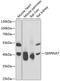 Serpin Family A Member 7 antibody, 22-122, ProSci, Western Blot image 