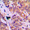 Heat Shock Protein Family B (Small) Member 1 antibody, LS-C354021, Lifespan Biosciences, Immunohistochemistry paraffin image 