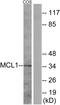 MCL1 Apoptosis Regulator, BCL2 Family Member antibody, LS-C117980, Lifespan Biosciences, Western Blot image 