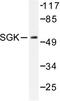 Serum/Glucocorticoid Regulated Kinase 1 antibody, LS-C176468, Lifespan Biosciences, Western Blot image 