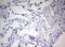 Zinc Finger E-Box Binding Homeobox 1 antibody, LS-C797953, Lifespan Biosciences, Immunohistochemistry frozen image 