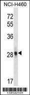 Fibroblast Growth Factor 10 antibody, 57-912, ProSci, Western Blot image 