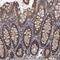Leucine Rich Repeat Containing 2 antibody, NBP1-85853, Novus Biologicals, Immunohistochemistry frozen image 