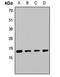 Slingshot Protein Phosphatase 2 antibody, orb412947, Biorbyt, Western Blot image 