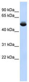 Translocation Associated Membrane Protein 1 Like 1 antibody, TA338839, Origene, Western Blot image 