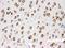 Transient Receptor Potential Cation Channel Subfamily M Member 5 antibody, PB9903, Boster Biological Technology, Immunohistochemistry frozen image 