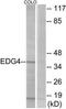Lysophosphatidic Acid Receptor 2 antibody, TA314869, Origene, Western Blot image 
