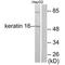 Keratin 16 antibody, A03393, Boster Biological Technology, Western Blot image 