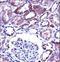 Transient Receptor Potential Cation Channel Subfamily V Member 1 antibody, LS-C160237, Lifespan Biosciences, Immunohistochemistry frozen image 