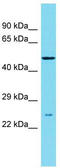 DNA Replication And Sister Chromatid Cohesion 1 antibody, TA335474, Origene, Western Blot image 