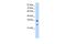 GIPC PDZ Domain Containing Family Member 2 antibody, GTX47176, GeneTex, Western Blot image 