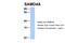 Sterile Alpha Motif Domain Containing 4A antibody, 30-918, ProSci, Western Blot image 