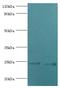 TIR Domain Containing Adaptor Protein antibody, MBS1492712, MyBioSource, Western Blot image 