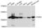 Poly(ADP-Ribose) Glycohydrolase antibody, PA5-76538, Invitrogen Antibodies, Western Blot image 