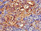 TNF Alpha Induced Protein 1 antibody, LS-C679839, Lifespan Biosciences, Immunohistochemistry paraffin image 