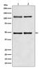 Nuclear Factor Kappa B Subunit 1 antibody, M00283, Boster Biological Technology, Western Blot image 