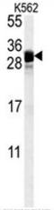 Fibroblast Growth Factor 7 antibody, AP51660PU-N, Origene, Western Blot image 