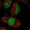 Zinc Finger Protein 749 antibody, NBP1-93996, Novus Biologicals, Immunocytochemistry image 
