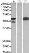 SS-A antibody, PA5-18147, Invitrogen Antibodies, Western Blot image 