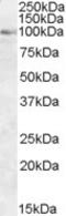 Oxysterol Binding Protein antibody, NB100-1329, Novus Biologicals, Western Blot image 