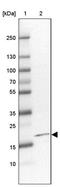 Growth Arrest And DNA Damage Inducible Beta antibody, PA5-56268, Invitrogen Antibodies, Western Blot image 