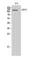 Serine Peptidase Inhibitor, Kazal Type 5 antibody, A03254, Boster Biological Technology, Western Blot image 