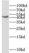 Melanin Concentrating Hormone Receptor 1 antibody, FNab05050, FineTest, Western Blot image 