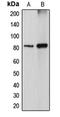 DGK-alpha antibody, LS-C352104, Lifespan Biosciences, Western Blot image 