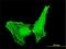 Actin Related Protein 1B antibody, H00010120-M05, Novus Biologicals, Immunocytochemistry image 