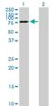 Dynein Cytoplasmic 1 Intermediate Chain 2 antibody, H00001781-B01P, Novus Biologicals, Western Blot image 