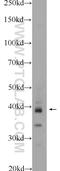 WD Repeat Domain 92 antibody, 25540-1-AP, Proteintech Group, Western Blot image 