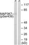 Mitogen-Activated Protein Kinase Kinase Kinase 7 antibody, TA313026, Origene, Western Blot image 